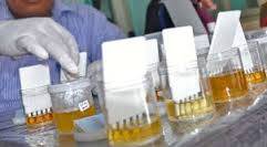 Enam Calon Pasangan Pengantin Tanjabtim Tes Urine
