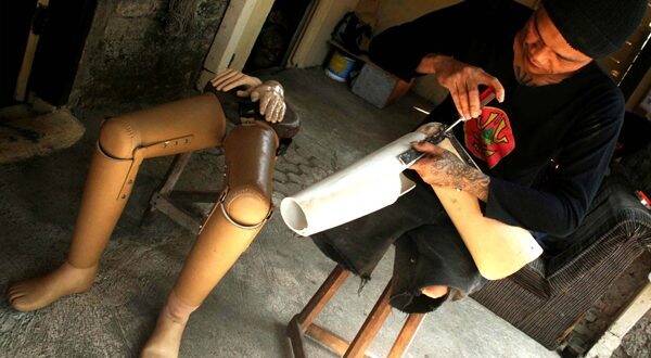 Pemprov Jambi Gratiskan Kaki Dan Tangan Palsu