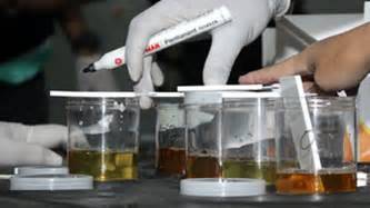 Polisi Tes Urine Polisi