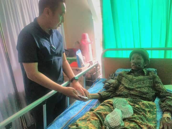 Tujuh Bulan Menderita Pembengkakan Dipipi