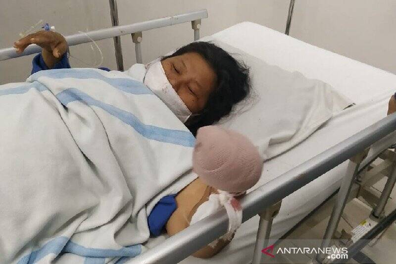 Begal Sadis! Bacok Tangan Kiri Wanita Paru Baya