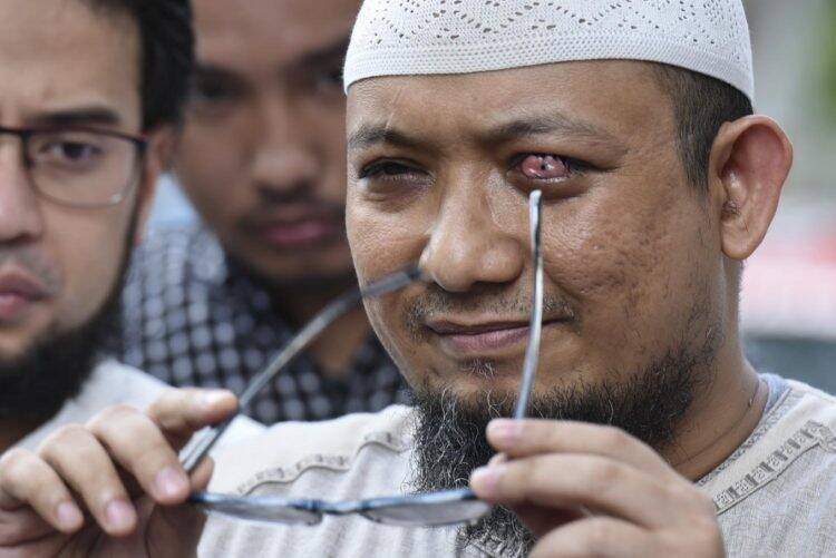 PSI Ungkap Keanehan Tuntutan Jaksa Dalam Kasus Novel