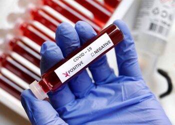 Masyarakat Sangat Cemas Tertular Covid-19