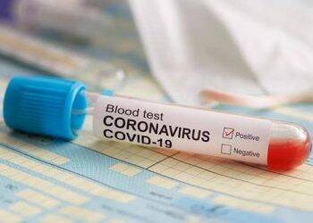 Dua Orang Warga Pemayung Positif  Covid 19