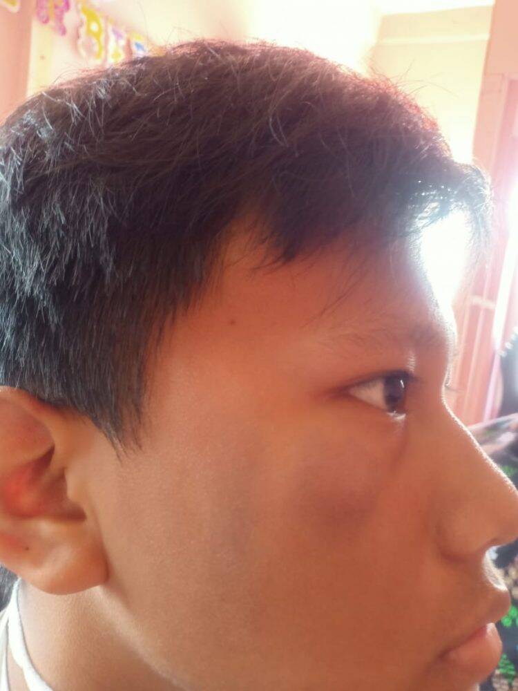 Anak Tuna Wicara dan Rungu Jadi Korban Pemukulan Debt Collector