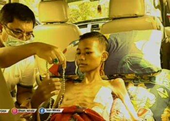 Anggota DPRD Ini Berikan Tasbih yang Dipakainya ke Anak Yatim Piatu Penderita TBC