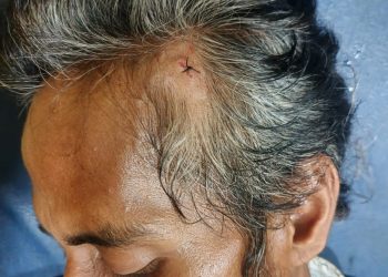Zulkarnain Pencari Barang Sungai Batanghari Diserang Orang Tak Dikenal di Desa Gedong Karya