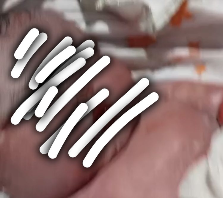 Bayi Meninggal dalam Kandungan Diduga Reaksi Suntikan Alergi Dokter Umum RSIA Milik Wali Kota Jambi